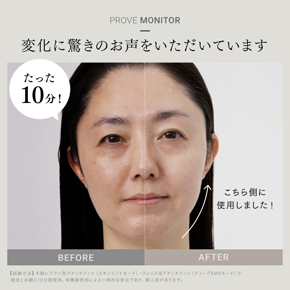 楽天市場】【公式｜期間限定 5%OFFクーポン+P5倍！】EMS 美顔器 リフト