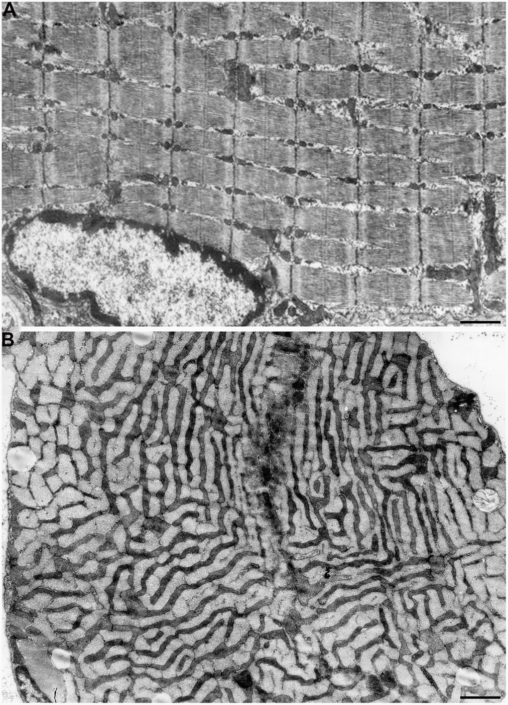 Progressive reorganization of mitochondrial apparatus in aging