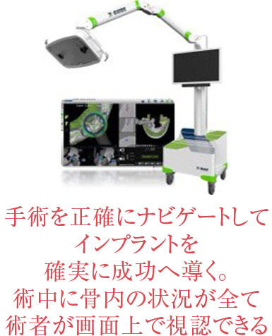 インプラント手術ナビゲーションシステムX-ガイド | 五十嵐歯科医院
