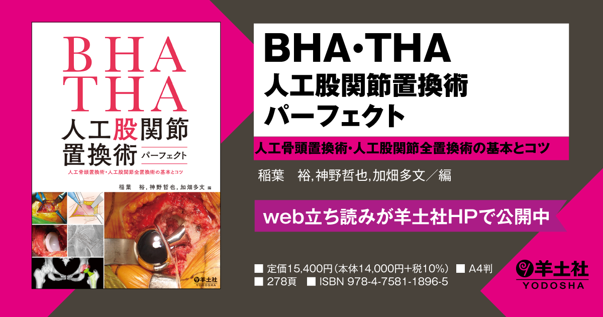 BHA・THA 人工股関節置換術パーフェクト〜人工骨頭置換術・人工股関節