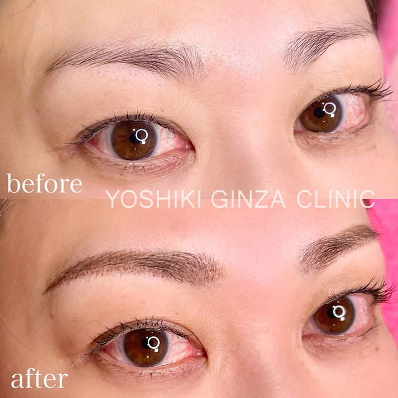 メディカルアートメイク｜よしき銀座クリニック