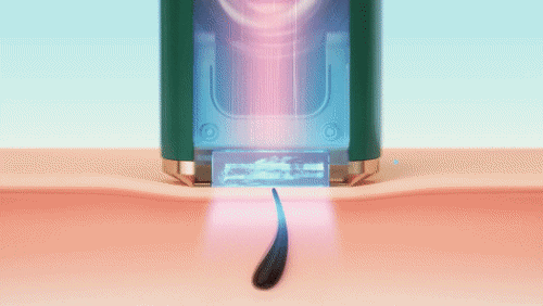 Ulike】Air+ IPL脱毛器 サファイア冷感 | Find