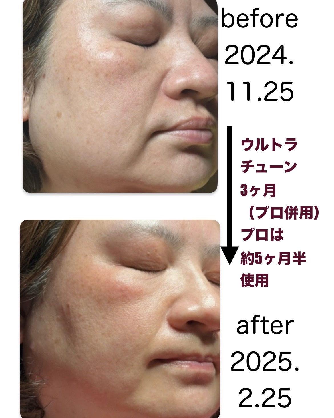 MEDICUBE(メディキューブ) / AGE-R ウルトラチューン40.68の公式商品