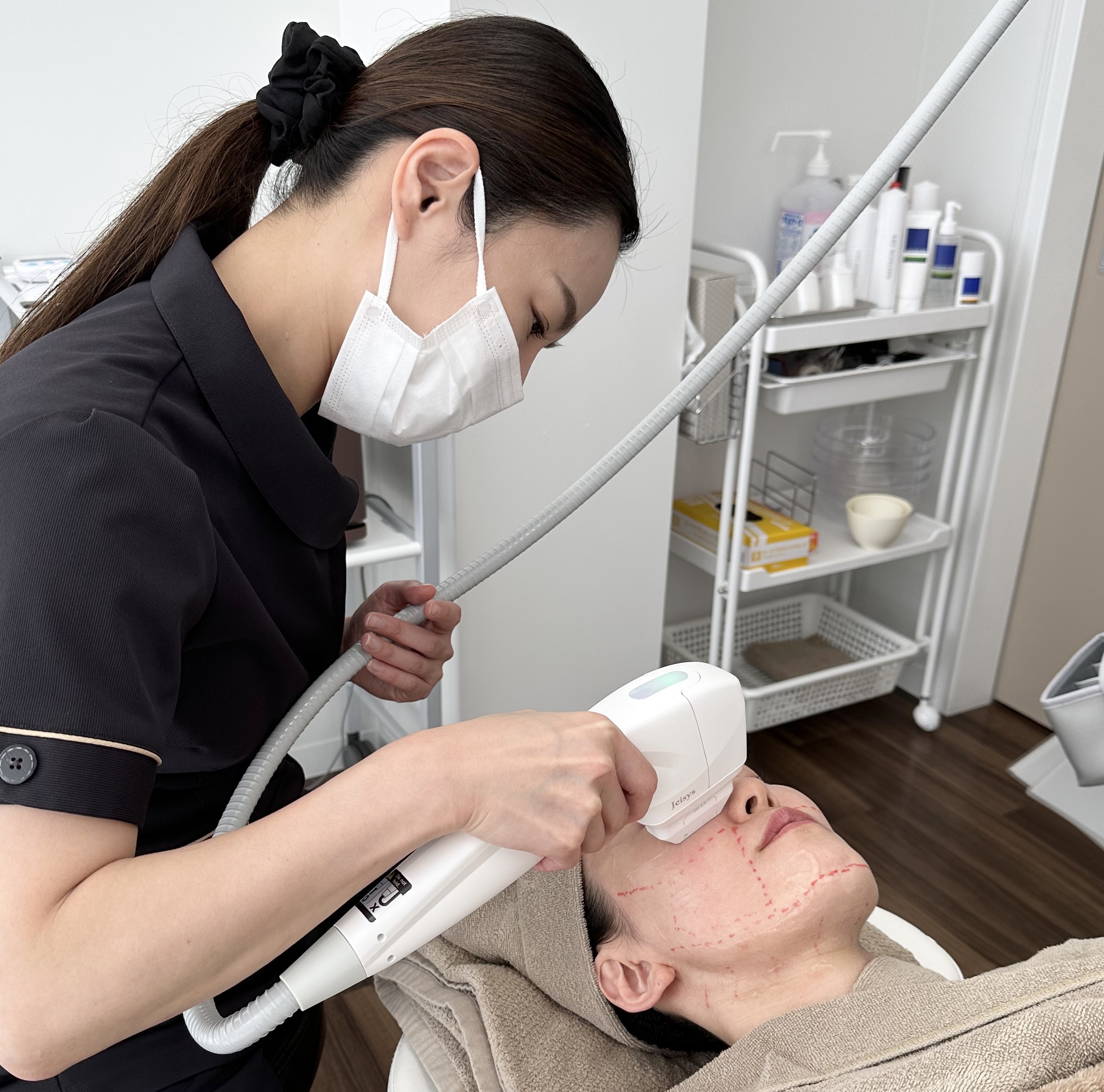 HIFU （ULTRAcelQ+） | 肌管理クリニック