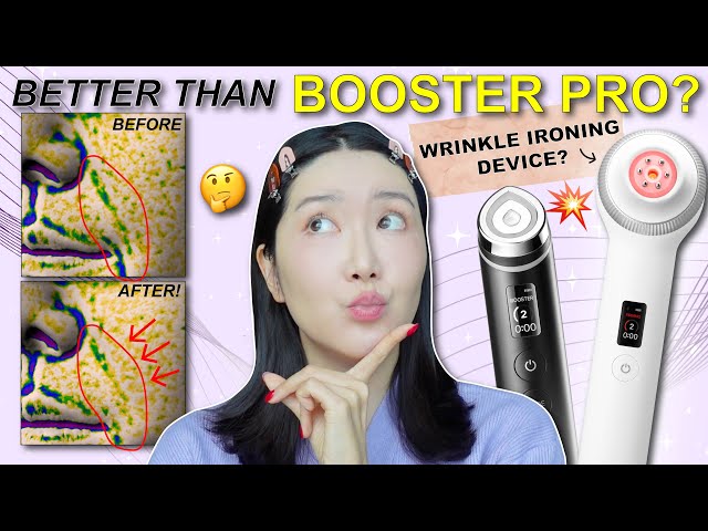 NEW Medicube Device to Plump Up My Laugh Line+Marionette Line in 4