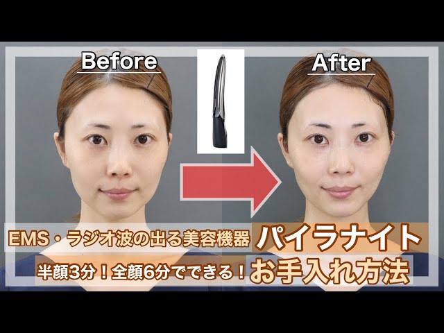 Beauty device loved by M's staff] We will explain how to use