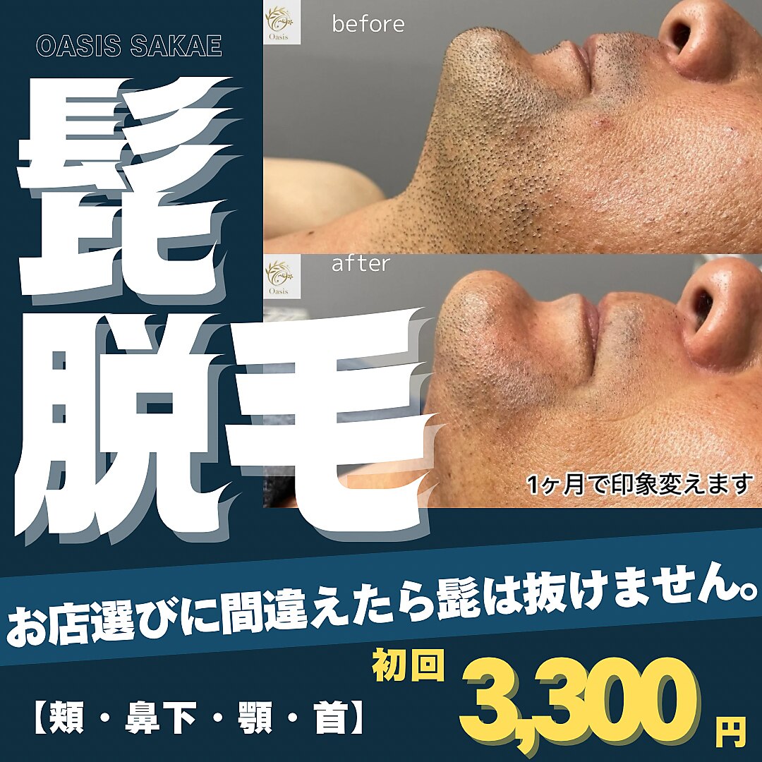 オアシスサカエ(OASIS SAKAE)｜ホットペッパービューティー