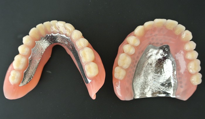 オーダーメイド精密義歯｜安城市 歯科医院 こもれび歯科