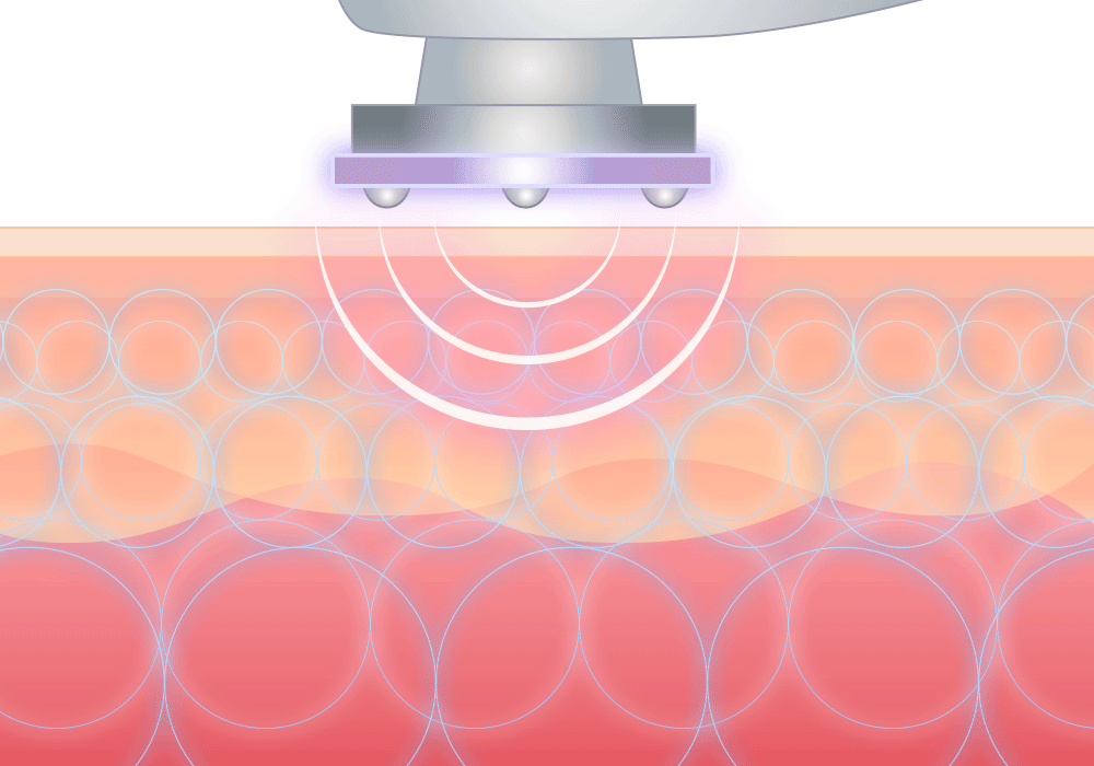 LALA LUCU RF｜ララルーチュRF