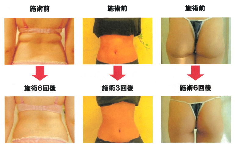 痩身｜お取り扱いメニュー｜エステサロンミナミナ｜宮城県加美郡加美町